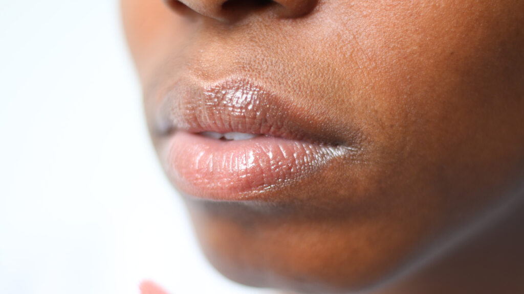 Herpes labial: o que é e como tratar a doença contagiosa?